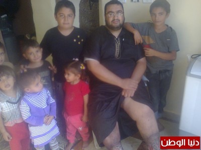 شاب ثلاثينى يخرج من رجليه الدود ويتسلخ لحمه 9998416935