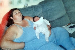 بالصور.. امرأة تحدت عمليات السمنة وفقدت 69 كجم من وزنها سمنه 1