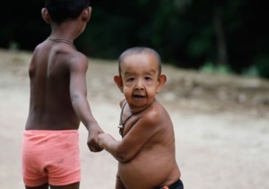 صور.. الطفل المسن يحير الأطباء الطفل المسن2