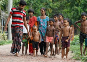 صور.. الطفل المسن يحير الأطباء الطفل المسن3